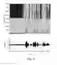 Fig. 07 - METHOD FOR COMPENSATING FOR HEARING LOSS IN A TELEPHONE SYSTEM AND IN A MOBILE TELEPHONE APPARATUS