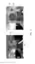 Fig. 04 - Image capturing device and digital zooming method thereof