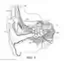 Fig. 02 - Binaural cochlear implant processing