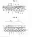 Fig. 06 - METHOD OF MANUFACTURING A FLEXIBLE PRINTED CIRCUIT BOARD INCLUDING A SOLDER RESIST LAYER