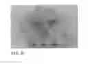 Fig. 07 - LOW DENSITY EDIBLE ANIMAL CHEWS AND METHODS OF MAKING SAME