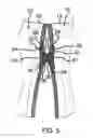 Fig. 06 - Sock Coupling Device