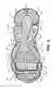 Fig. 08 - Sole structures and articles of footwear having a lightweight midsole with segmented protective elements