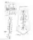 Fig. 02 - Combination hidden necktie restraint and buttoning-assist device