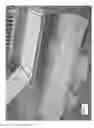 Fig. 13 - PORTABLE BEACH CHAIR COVER