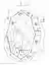 Fig. 02 - Disassemblable and Carryable Beach/Park Corral