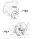 Fig. 03 - Adjustable endoscope sheath