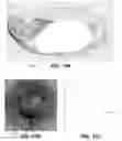 Fig. 15 - Coupled reconstruction of refractive and opaque surfaces