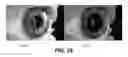 Fig. 29 - Coupled reconstruction of refractive and opaque surfaces