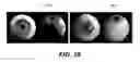 Fig. 30 - Coupled reconstruction of refractive and opaque surfaces