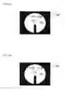 Fig. 14 - Ophthalmological apparatus