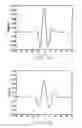 Fig. 12 - ELECTROCARDIOGRAPHY SIGNAL EXTRACTION METHOD