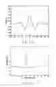 Fig. 13 - ELECTROCARDIOGRAPHY SIGNAL EXTRACTION METHOD