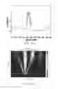 Fig. 35 - ELECTROCARDIOGRAPHY SIGNAL EXTRACTION METHOD