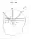 Fig. 33 - Apparatus for measuring bioelectrical signals