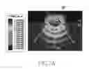 Fig. 09 - APPARATUS AND METHOD FOR ANALYZING BODY TISSUE LAYER IN ELECTRONIC DEVICE