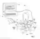 Fig. 02 - Apparatus and method for endovascular device guiding and positioning using physiological parameters