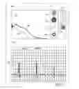 Fig. 08 - Apparatus and method for endovascular device guiding and positioning using physiological parameters