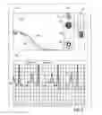 Fig. 09 - Apparatus and method for endovascular device guiding and positioning using physiological parameters