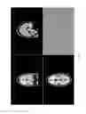 Fig. 04 - Technologies for white matter hyperintensity quantification