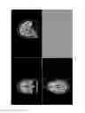 Fig. 06 - Technologies for white matter hyperintensity quantification