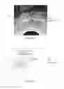 Fig. 04 - MRI IMAGE FUSION METHODS AND USES THEREOF