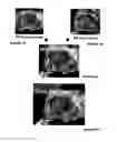 Fig. 10 - MRI IMAGE FUSION METHODS AND USES THEREOF