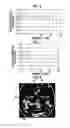 Fig. 05 - Acne-affected skin determination method and acne-affected skin determination device