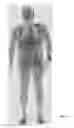 Fig. 10 - Multi-beam stereoscopic X-ray body scanner