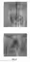 Fig. 11 - Multi-beam stereoscopic X-ray body scanner