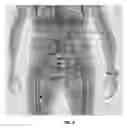 Fig. 12 - Multi-beam stereoscopic X-ray body scanner