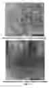 Fig. 14 - Multi-beam stereoscopic X-ray body scanner