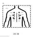 Fig. 06 - Method, system and device for auscultation