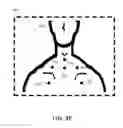 Fig. 09 - Method, system and device for auscultation
