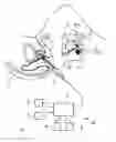 Fig. 01 - Imaging apparatus for biopsy or brachytherapy