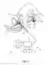 Fig. 02 - Imaging apparatus for biopsy or brachytherapy