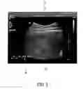 Fig. 06 - Elastography measurement system and method