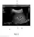 Fig. 07 - Elastography measurement system and method