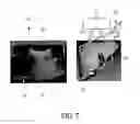 Fig. 08 - Elastography measurement system and method