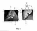 Fig. 09 - SYSTEM AND METHOD FOR MAPPING ULTRASOUND SHEAR WAVE ELASTOGRAPHY MEASUREMENTS