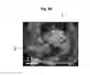 Fig. 16 - Probe, ultrasound imaging apparatus and controlling method of the ultrasound imaging apparatus