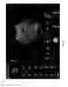 Fig. 03 - Method and system for snapshot support for real-time ultrasound