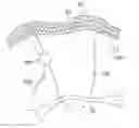 Fig. 01 - System for intra-abdominally moving an organ