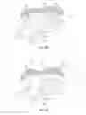 Fig. 10 - System for intra-abdominally moving an organ