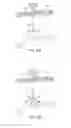 Fig. 11 - System for intra-abdominally moving an organ