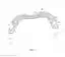 Fig. 17 - System for intra-abdominally moving an organ