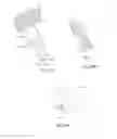 Fig. 22 - System for intra-abdominally moving an organ