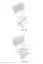 Fig. 23 - System for intra-abdominally moving an organ
