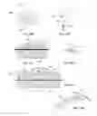 Fig. 31 - System for intra-abdominally moving an organ