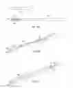 Fig. 34 - System for intra-abdominally moving an organ